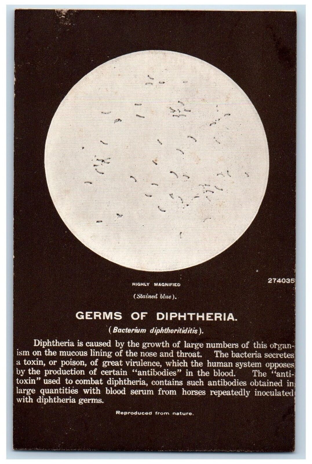 c1950's Germs Of Diphtheria Microscopic Plants Through Lenses Bacteria Postcard