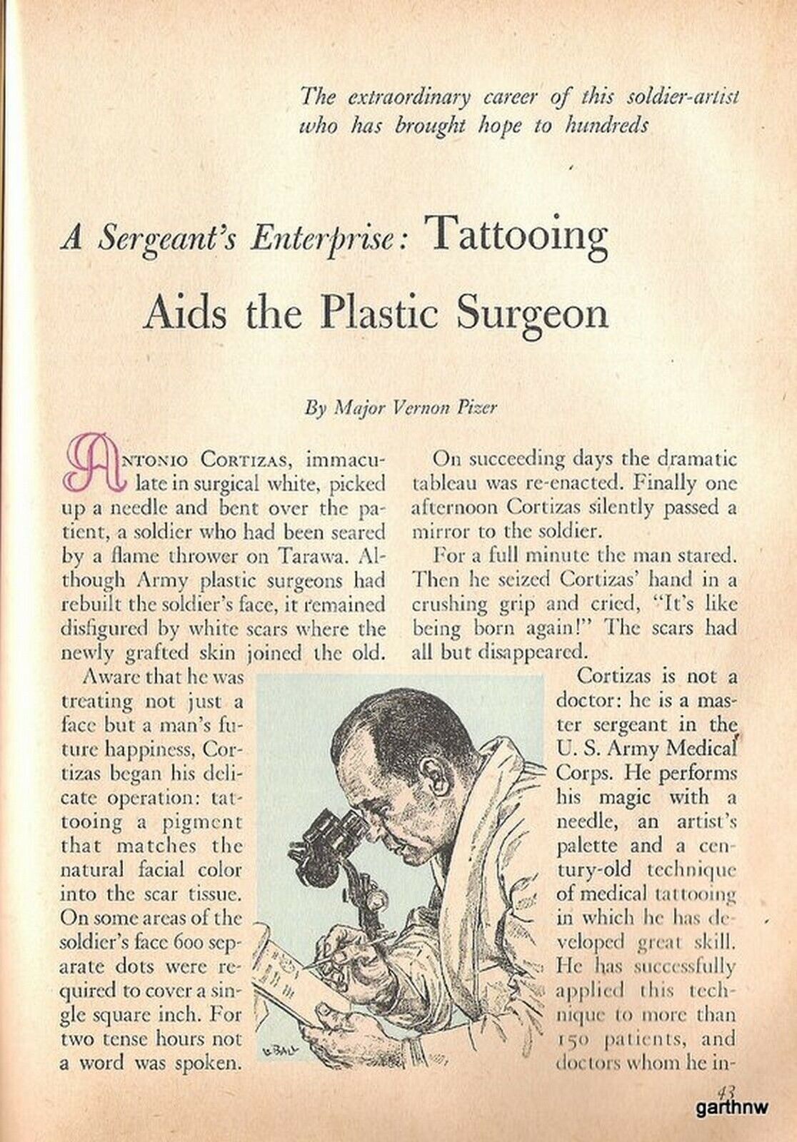 TATTOO PLASTIC SURGERY FOR VETERANS 1952 FEATURE COVERING WAR WOUNDS